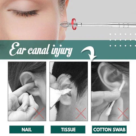 DermaClean™ - 6 - in - 1 Set Ear Wax Removal Kit (50% Off) - Evesbury
