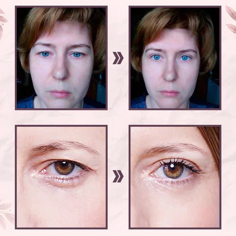 LumiLift™ - Instant Eyelid Lift Strips 180 Pairs (50% Off) - Evesbury