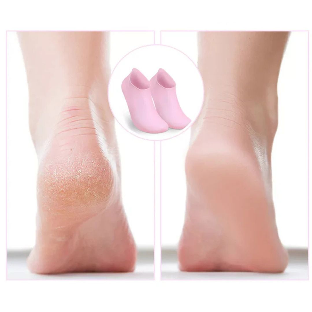Feeluxe™ - Dry Foot Moisturising Pedicure Socks (1+1 Free) - Evesbury