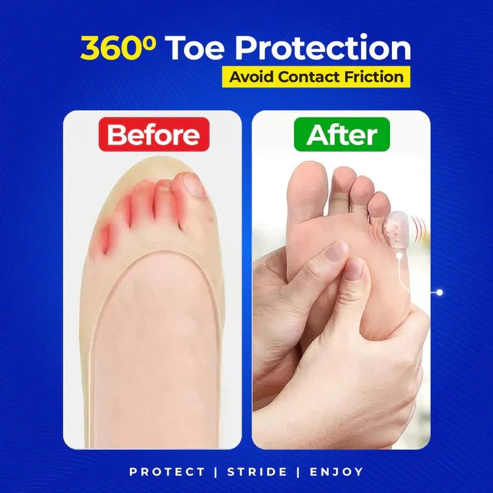 Feeluxe™ - Anti - Friction Silicone Toe Protectors (2+3 Free) - Evesbury
