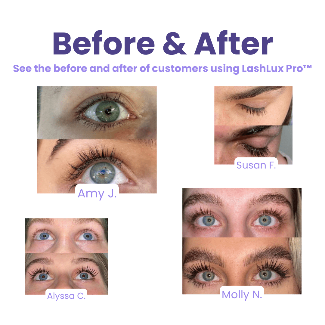 LashLux Pro™ - Lash Growth Serum (50% Off) - Evesbury